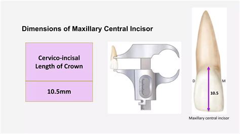 Morphology of Permanent Maxillary Central Incisor- Dr. Saba Arshad.pptx