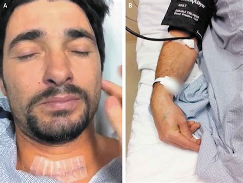 Chvostek sign and Trousseau sign