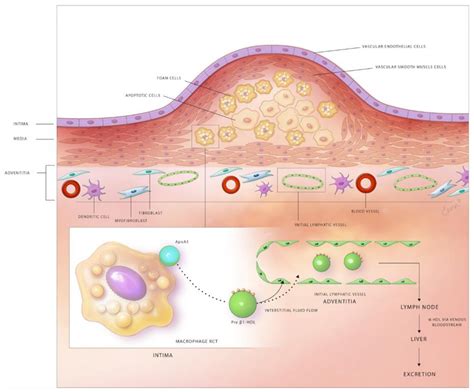 Arterial Lymphatics in Atherosclerosis: Old Questions, New Insights ...