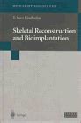 Buy Skeletal Reconstruction and Bioimplantation (Medical Intelligence ...