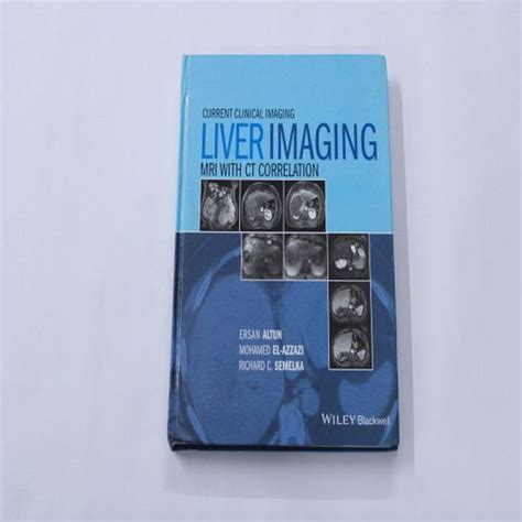 Current Clinical Imaging Liver Imaging(MRI with CT Correlation): Buy ...