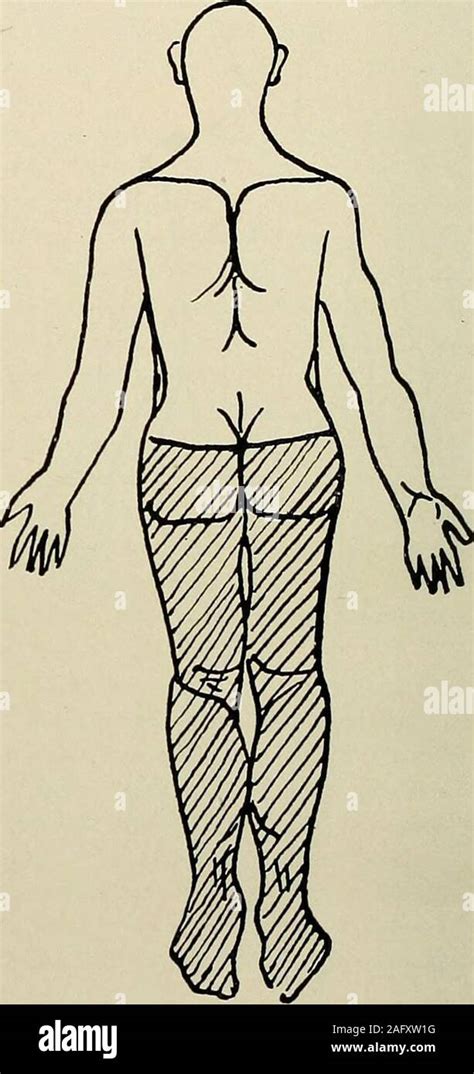 Image result for Cremasteric Muscle Contraction