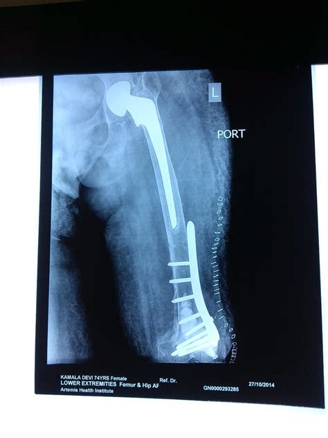 SSV Specialized Ortho Care Centre image gallery | SSV Specialized Ortho ...