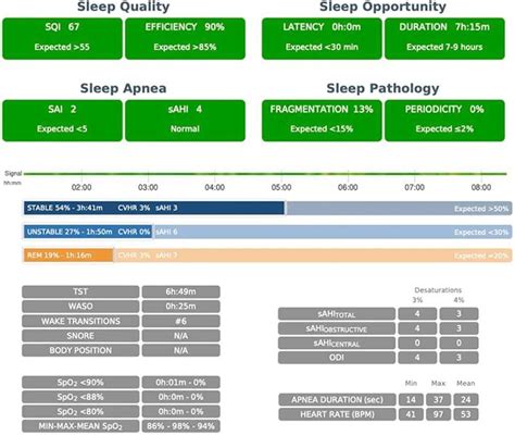 Sleep Connection Test 的图像结果
