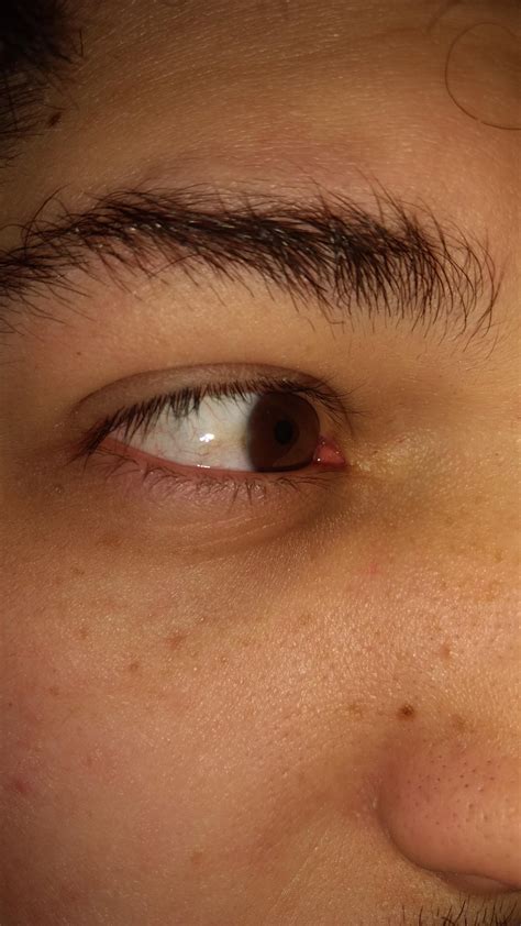 Yellowish Eyes Michelle Trachtenberg Addressed Fans' Concerns Over Her