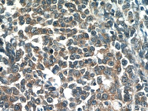 OSBPL9 antibody (11879-1-AP) | Proteintech
