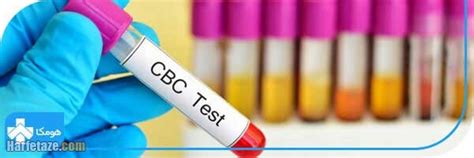 آزمایش CBC خون چه بیماری‌هایی را نشان می‌دهد؟ حرف تازه