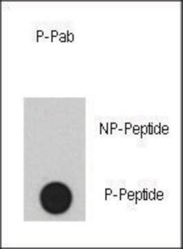 phospho-INSR-Y1361 antibody Immunohistochemistry, ELISA SAB1300309 Anti-IR