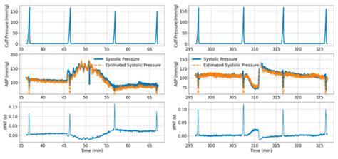 Sensors | Special Issue : Sensors and Biomedical Signal Processing for ...