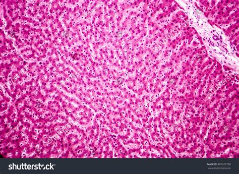 111 Liver Sinusoid Images, Stock Photos & Vectors | Shutterstock