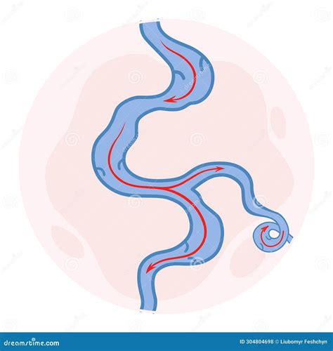 Varicose Veins. Blue Blood Vessel Visible through the Skin. Vascular Disease Diagnostic and ... - treat venous disease