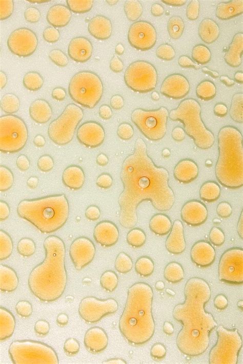 What pus cells in urine mean and how it’s typically a sign of infection ...
