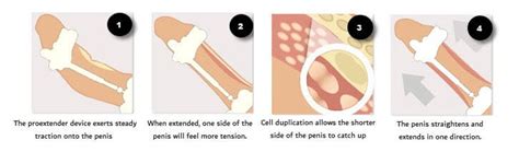 Image result for How to Use ProExtender