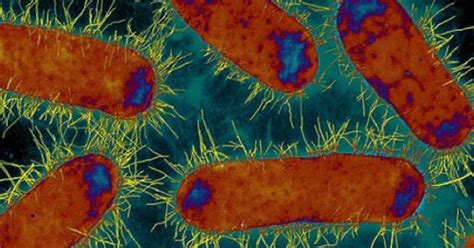 Lab notes: Finding the Achilles heel of drug-resistant superbugs