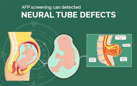 Image result for How AFP Test Done