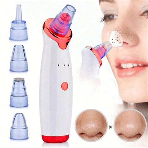 Facial Blackhead Remover Vacuum Pore Adsorber Electric Pimple Blackhead ...