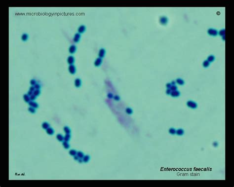 Image result for Enterococcus Faecalis Bacteria Cell Structure