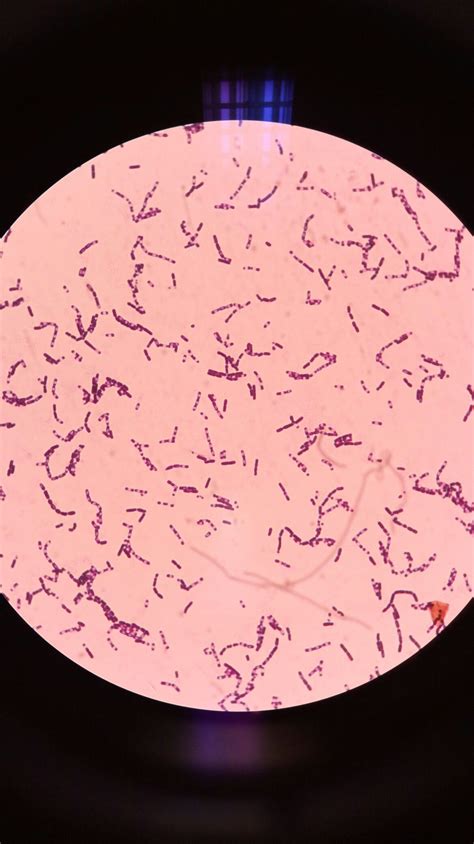 Microscope Bacteria 的图像结果