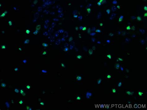 SOX2 antibody (66411-1-Ig) | Proteintech