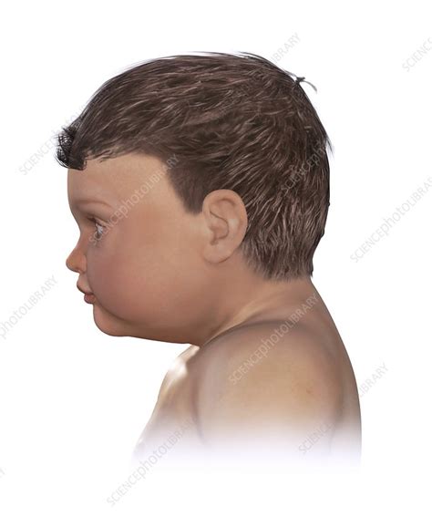 Image result for Normal Head Size
