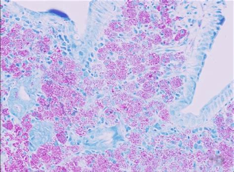 Image result for Acid-Fast Bacilli Staining Method