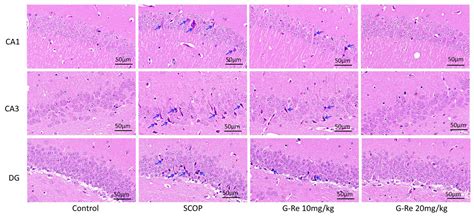 Ginsenoside Re Regulates Oxidative Stress through the PI3K/Akt/Nrf2 ...