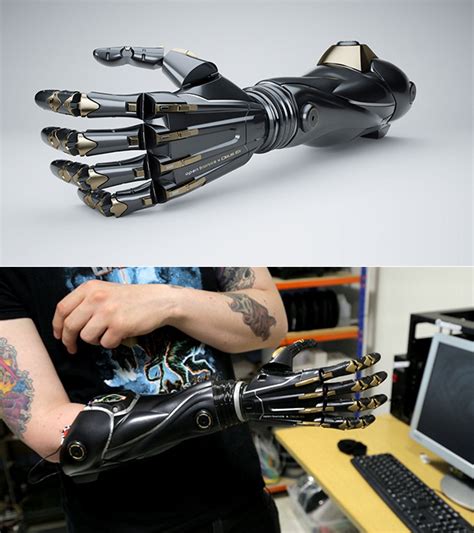 Image result for Bionic Arm Prosthetics
