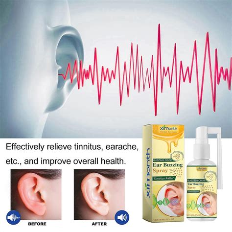 Ear Buzzing Spray 60ml, Tinnitus Relief for Ringing Ears, Tinnitus ...