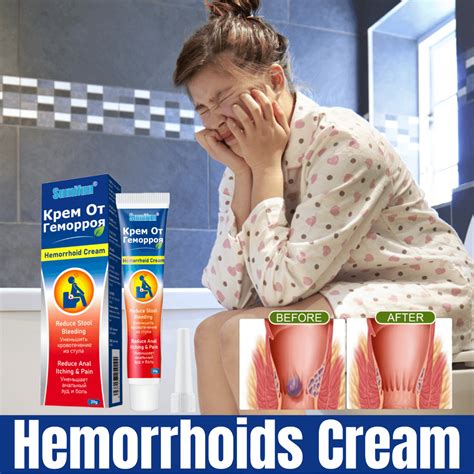 Hemorrhoids Cream Herbal Ointment Gel Quickly Relieves Pain Itchiness Shrinks Swollen Tissue ...