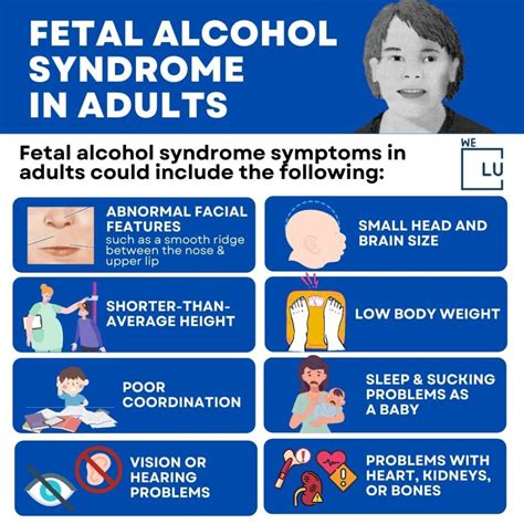 Severe Fetal Alcohol Syndrome Adult