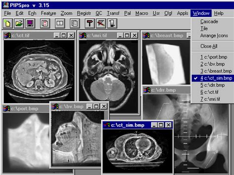 Image result for Image Processing Software for Medical