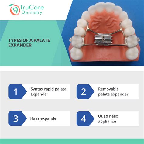 Palate Expander Exercises at Darren Pennington blog