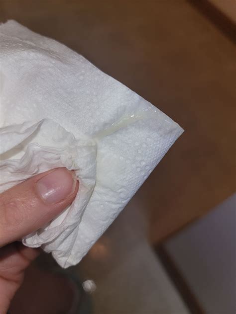 6 dpo- discharge? | BabyCenter