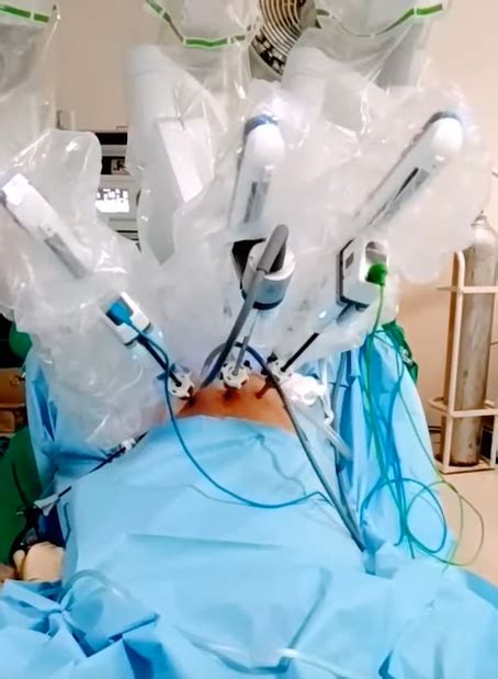 India’s first robotic kidney transplant successfully performed at AIIMS ...