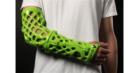 ActivArmor 3D Casts & Splints: Custom, Comfortable & Durable