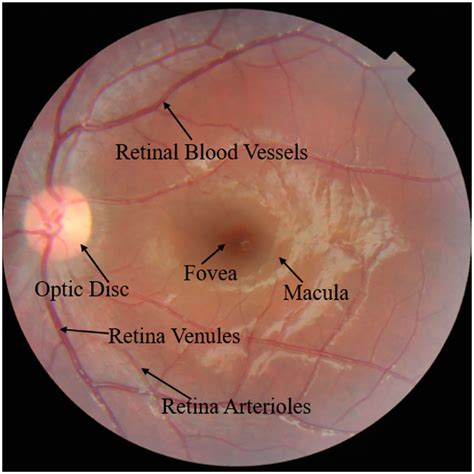 Image result for Normal Human Eye