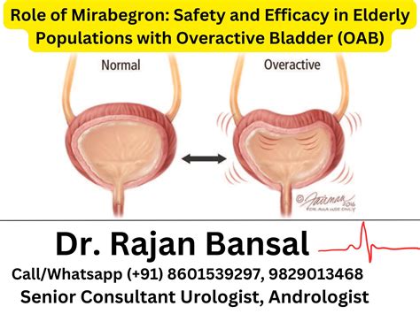 Meatal Stenosis: Causes, Symptoms, Diagnosis, and Treatment