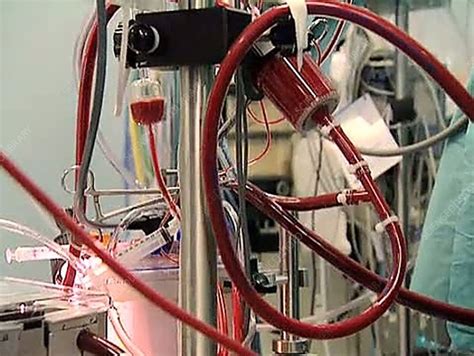 Blood Pumping Machine 的图像结果