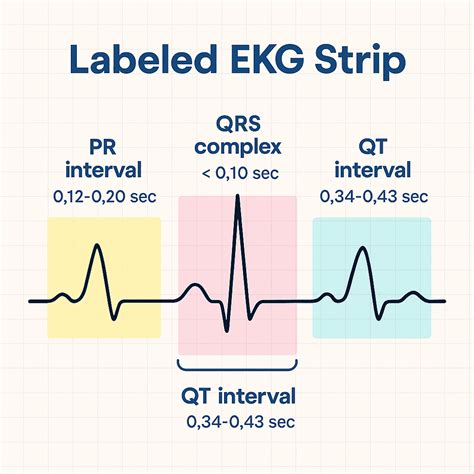 Understanding EKG Intervals: PR, QRS, and QT Made Easy