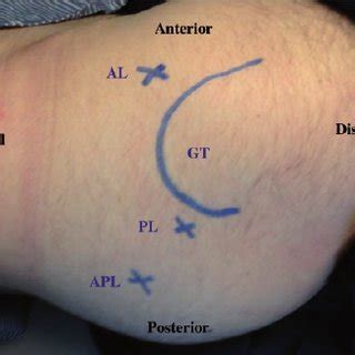Medial Hamstring Reflex Test 的图像结果