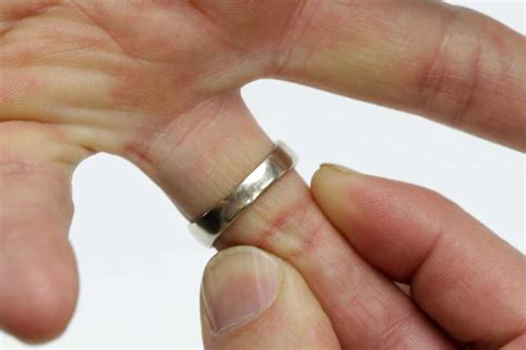 Image result for Ring Removal String Technique