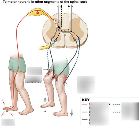 Image result for Crossed Extensor Reflex Demonstration