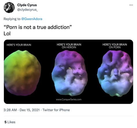 Heroin Brain Before And After