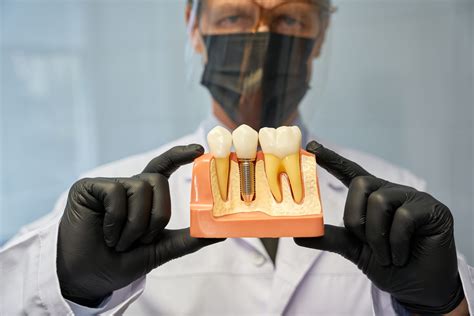 A Guide to Properly Maintain Your Dental Crowns