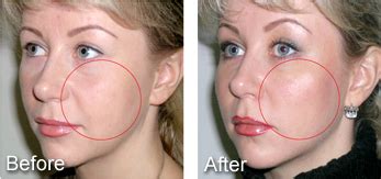 Image result for Face Threads