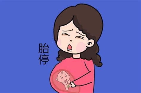 孕期出现“胎停育”,而你对它还是一知半解吗？