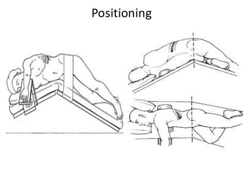 Image result for Simple Nephrectomy