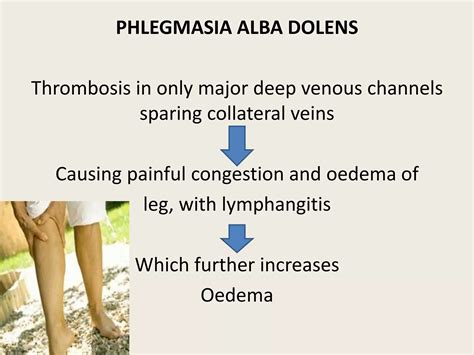 Deep vein thrombosis | PPTX