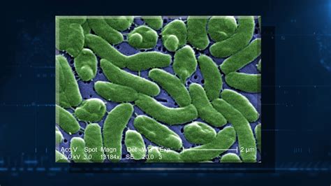 Does Cold Salt Water Kill Bacteria at Ruby Najar blog