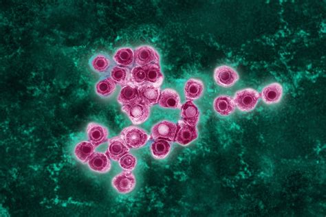 More adults under age 50 are getting shingles. Why? | National Geographic